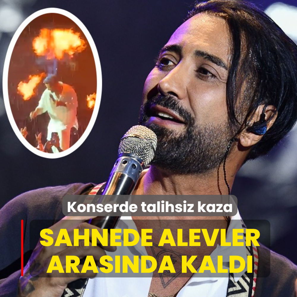 Tan Ta��� sahnede alevler aras�nda kald�! Y�z� yand�