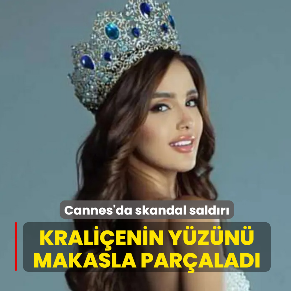 Krali�enin y�z�n� makasla par�alad�