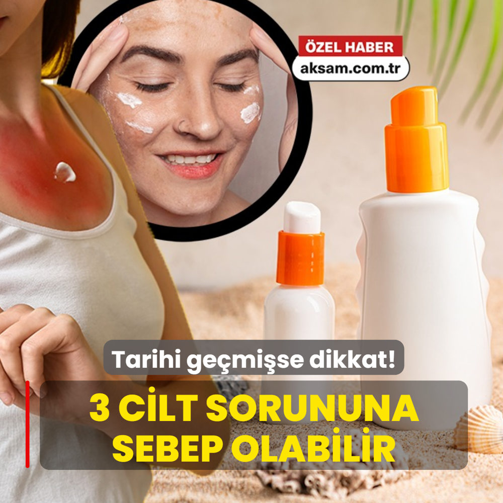 Tarihi ge�mi� g�ne� kremini kullananlar� bekleyen 3 cilt sorunu! Uzman� en �ok yap�lan yanl��� a��klad�