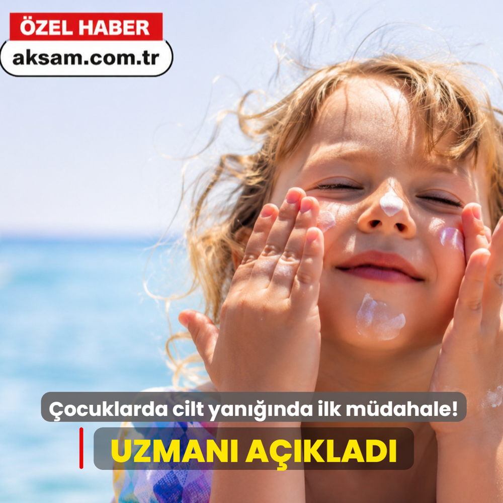 �ocuklarda cilt yan���nda ilk m�dahale! Uzman� a��klad�