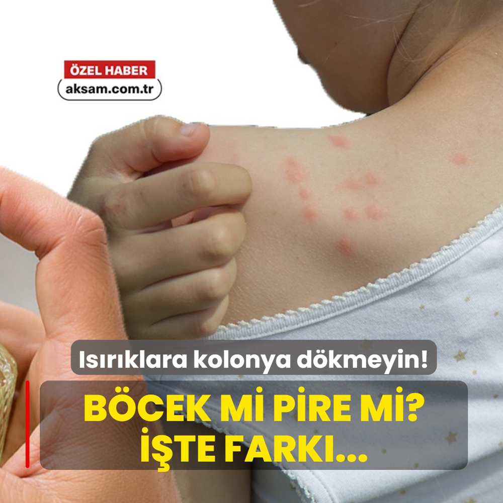 Is�r�klara kolonya d�kmeyin! Uzman� b�cek ve pire �s�r�klar�n� ay�rt etmenin tek y�ntemini a��klad�
