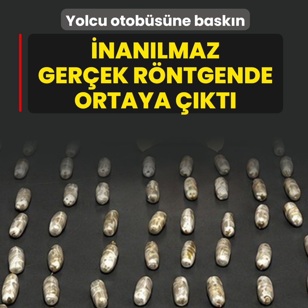 Yolcu otob�s�ne bask�n! �nan�lmaz ger�ek r�ntgende ortaya ��kt�