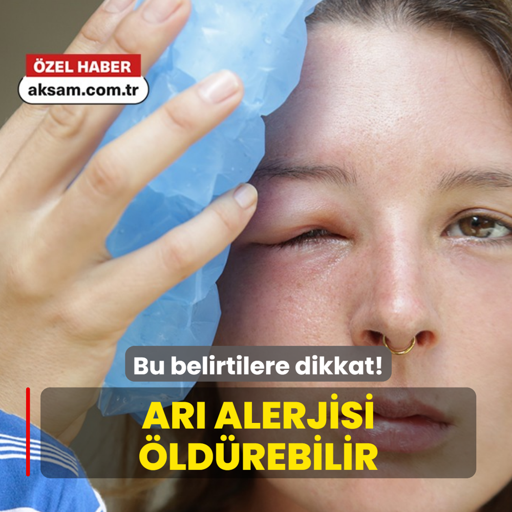Dikkat! Ar� alerjisi �ld�rebilir! ��te �ocuklar ve yeti�kinler aras�ndaki farklar