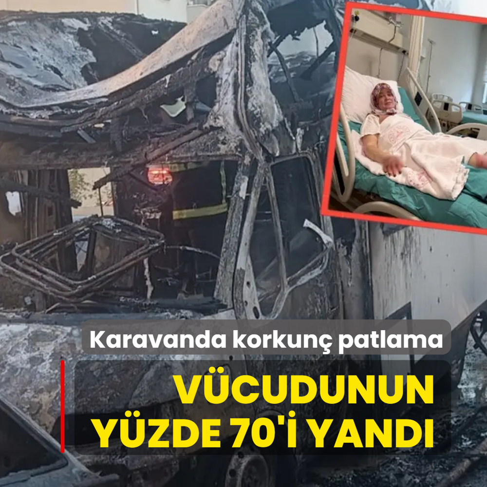 Karavanda korkun� patlama! Ailece �l�mden d�nd�ler, v�cudunun y�zde 70'i yand�
