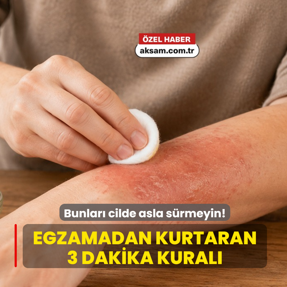 Egzamal� cilde ne sirke ne kantaron ya�� s�rmeyin! Uzman� egzamadan kurtaran 3 dakika kural�n� a��klad�