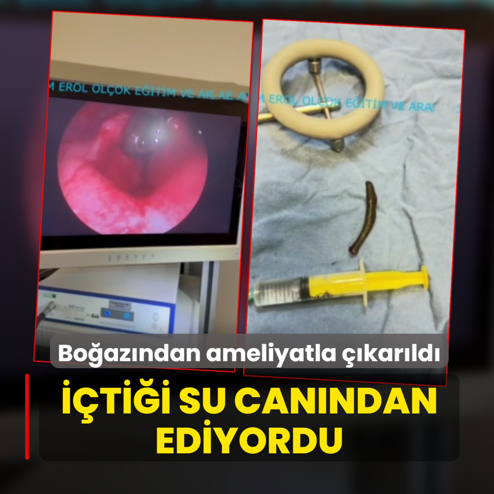 ??ti?i su can?ndan ediyordu! Bo?az?ndan ameliyatla ??kar?ld?