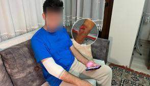 Kpek saldrsnda kanlar iinde kald