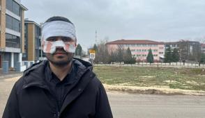 Rehber ��retmen, fizik ��retmenini kaynar �ayla ha�lad�