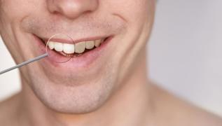 Sararmış dişleri beyazlatmanın 5 yolu