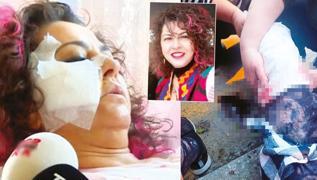 Akademisyen yetkililerden yardm talep etti! 'Babo kpekler insan haklar sorunu'