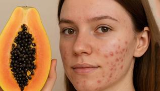 Sivilceleri 1 haftada yok eden meyve: Hem antioksidan hem vitamin
