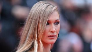 Bella Hadid'in zor gnleri: Lyme hastalyla mcadelesini paylat!