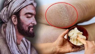 bn-i Sina srarla tavsiye ediyor: Nasrdan kurtulmak iin tereyan byle kullann