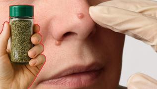 Siilleri skp atan baharat! bn-i Sina'nn baharat forml ne kurt brakyor ne mikrop