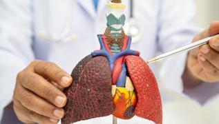 Dikkat! Kt huylu nodl kanser iareti olabilir