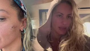 iddet grdn iddia eden Yldz Asyal yardm istedi! Umarm bama daha kt eyler gelmez'