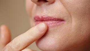 Demir eksikli�inin 7 belirtisi: Kendini soluk dudaklardan belli ediyor