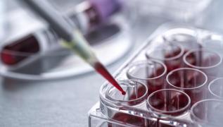 Kanser tedavilerinde yeni geli�meler! Uzman� a��klad�