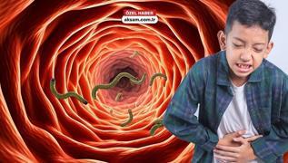 Sinsi tehlike: Ba��rsak kurtlar�! �ocu�un boyunu da di�lerini de etkiliyor