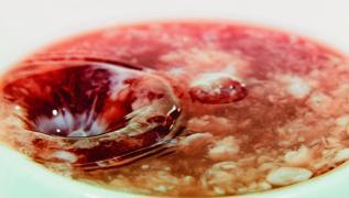 Me�er ta� yap�yormu�! Sa�l�kl� diye bardak bardak i�iyoruz: B�brekleri iflas ettiriyor