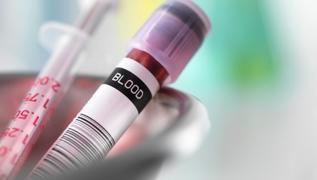 Bu kan grubundaysan�z diyabet �anlar� �alabilir! Bilim insanlar� a��klad�