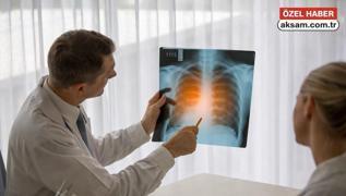 Uzman� a��klad�! �nat�� �ks�r�k akci�er kanserinin belirtisi midir?