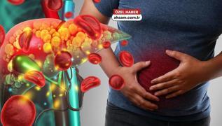 2050'ye kadar 2 milyar ki�i karaci�er hastas� olabilir! Organ Nakli Uzman� uyard�: Gizli belirtilere dikkat!