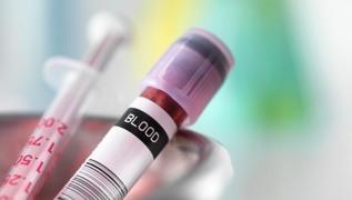 Enfeksiyon onlara u�ram�yor: En sa�l�kl� kan grubu