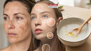 Y�zdeki g�ne� lekelerine yeni �neri: Pirin� suyu! Buzdolab�nda saklay�n, her gece s�r�n