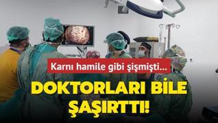 Karn hamile gibi imiti... Doktorlar bile artt!