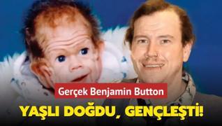 Gerek Benjamin Button... Yal dodu, genleti!