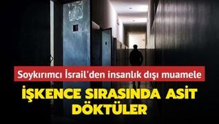 Soykrmc srail'den insanlk d muamele: Filistinli mahkuma ikence srasnda asit dktler