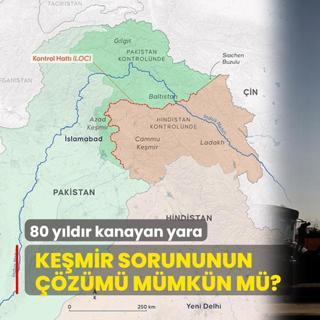 80 yldr kanayan yara! Kemir sorununun zm mmkn m?