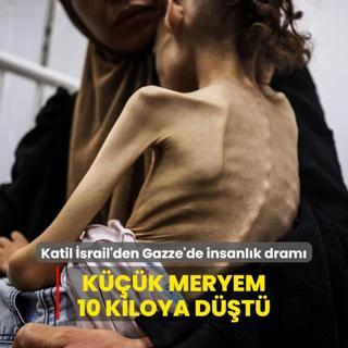 Soykrmc srail'den Gazze'de insanlk dram: Kk Meryem 10 kiloya dt