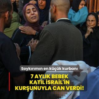 Soykrmn en kk kurban... 7 aylk bebek katil srail'in kurunuyla can verdi!
