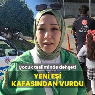 ocuk tesliminde dehet! Yeni ei kafasndan vurdu