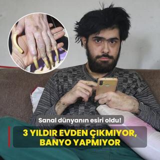 Sanal dnyann esiri oldu! 3 yldr evden kmyor, banyo yapmyor