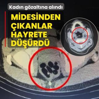 Midesinden kanlar hayrete drd! Kadn gzaltna alnd