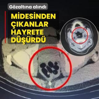 Midesinden kanlar hayrete drd! Gzaltna alnd