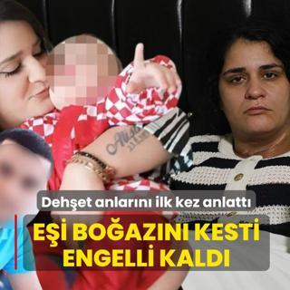Ei boazn kesti, yzde 96 engelli kald: Dehet anlarn ilk kez anlatt