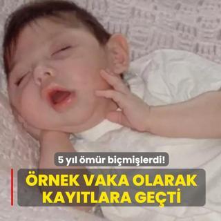 Beyin'siz 20 ya mucizesi