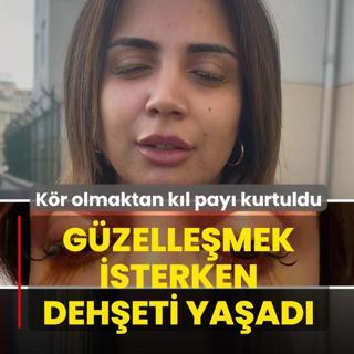Gzellemek isterken deheti yaad! Kr olmaktan kl pay kurtuldu