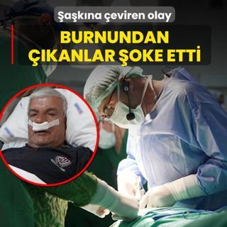 akna eviren olay! Burnundan kanlar oke etti