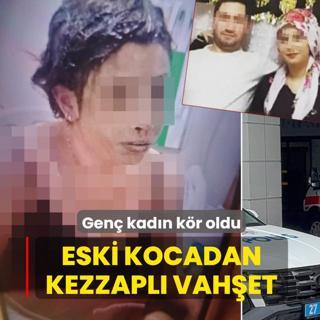 Eski kocadan kezzapl� vah�et! Gen� kad�n k�r oldu