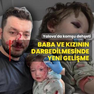 Yalova'da kom�u deh�eti! Baba ve 14 ayl�k k�z�n darbedilmesinde yeni geli�me