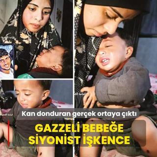 Gazzeli bebe�e Siyonist i�kence