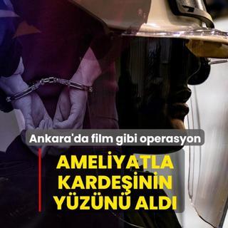 Ameliyatla karde�inin y�z�n� ald�! Ankara'da film gibi operasyon