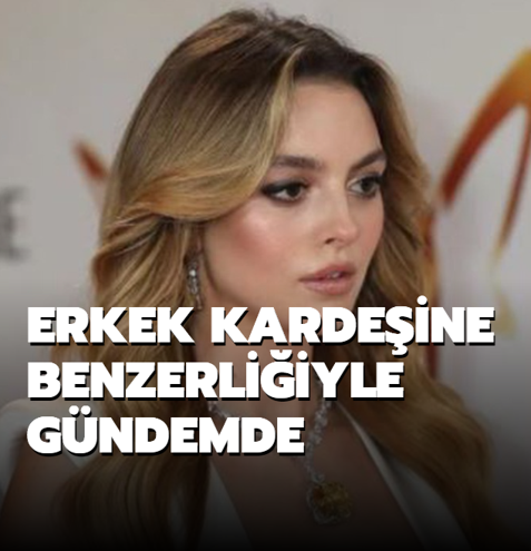 Erkek karde�ine benzerli�iyle g�ndemde
