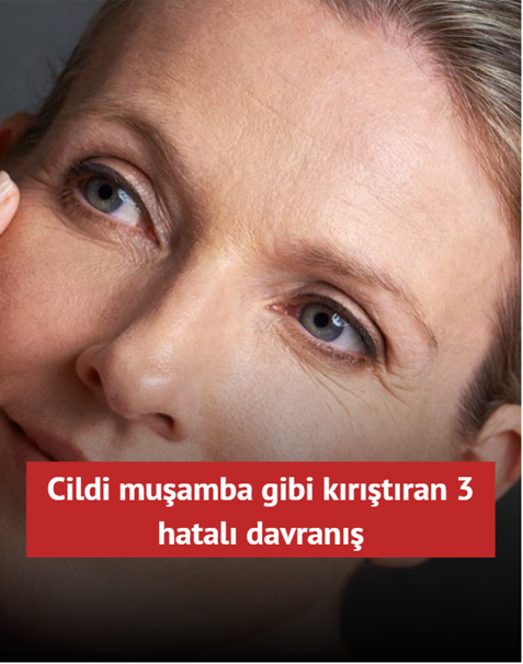 Cildi mu�amba gibi k�r��t�ran 3 hatal� davran��