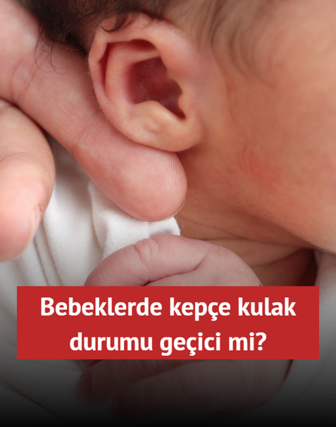 Bebeklerde kepe kulak durumu geici mi? Ameliyatsz deiim mmkn m?